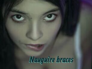 Nauguire_braces